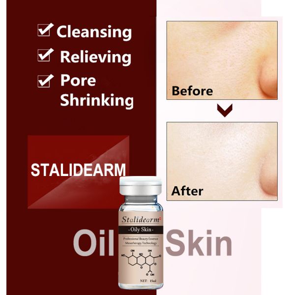 Meso Skin Care No Needle Mesotherapy Solution Oily Skin Meso Micro-Needling Serum Customized Private Label OEM Factory Price