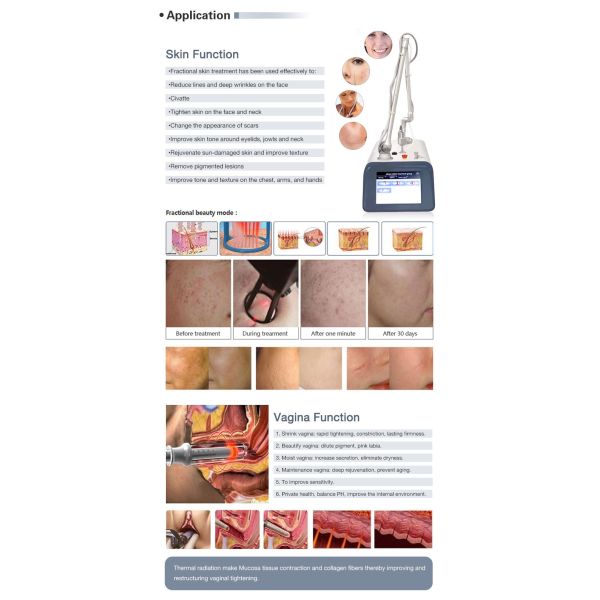 Fractional Co2 Laser Machine Pigment Removal Scar Removal Large Pores Treatment 110V-250V