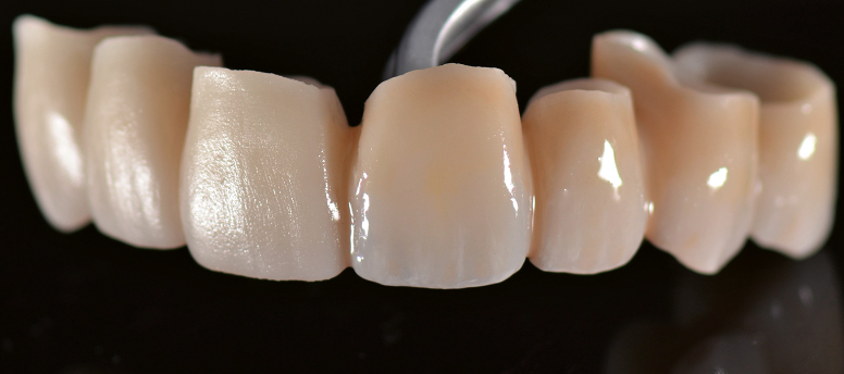 Prettau Wieland Zenostar Dental Zirconia Block CAD CAM Milling 1200 Mpa