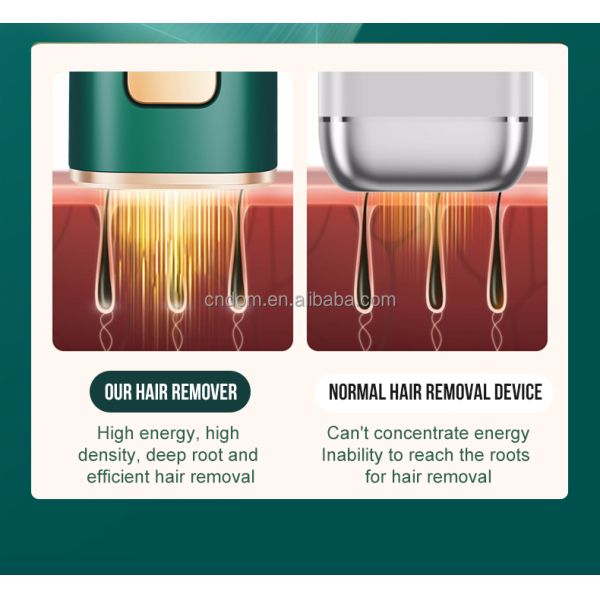 Get Rid of Unwanted Hair at Home IPL Intense Pulsed Light with Ice Cooling Technology