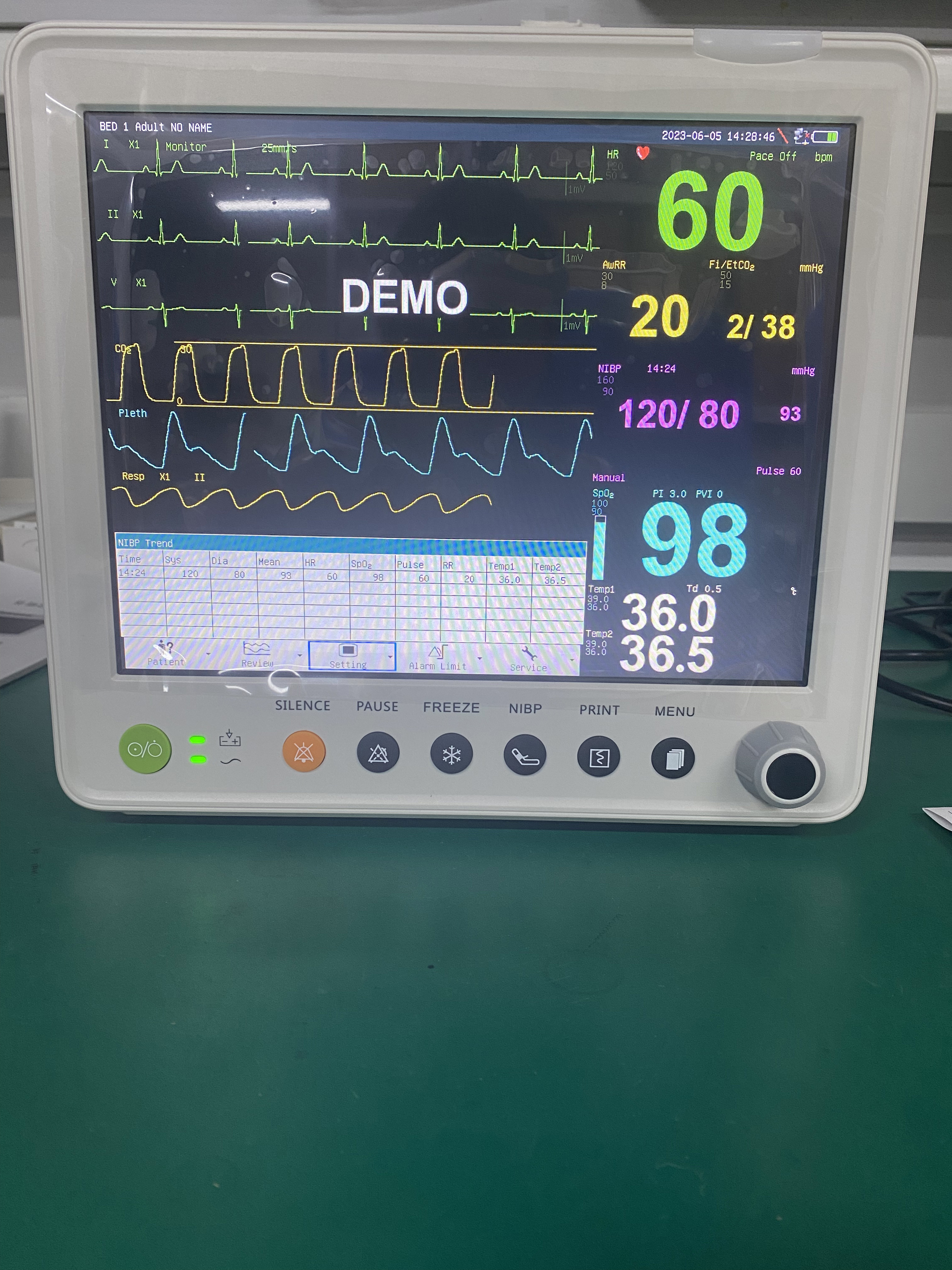 Портативный терпеливый монитор с параметрами PR ETCO2 ECG NIBP SPO2 RESP TEMP