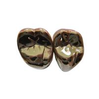 High Strength FMC Metal Crown Tooth Semi Precious Metal Crown