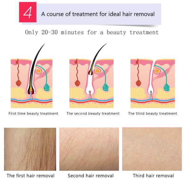 3000W IPL SHR Hair Removal Machine , Anti Aging Multifunctional Beauty Equipment