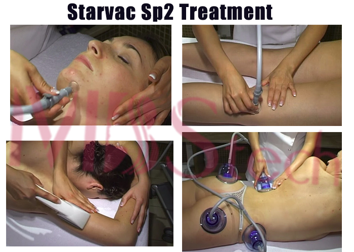 Машина RF ролика вакуума Starvac Sp2