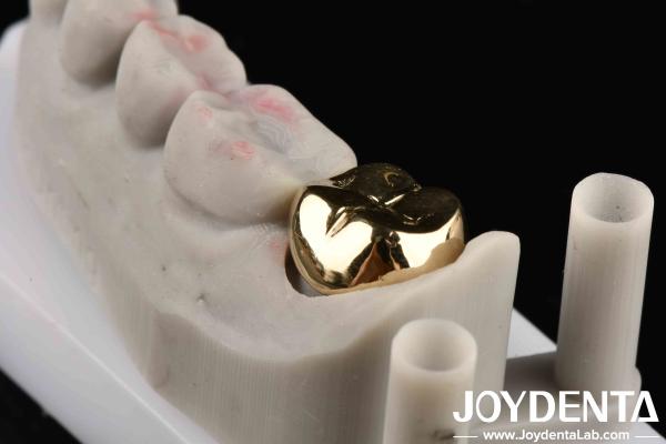Professional Grade Gold Crown For Dental Oral Clinical Application Yes Abrasive Resistance