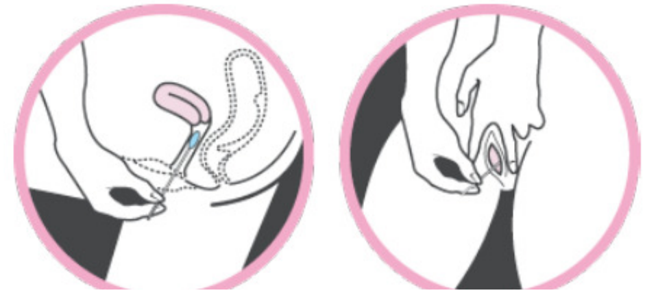 Аксессуары наборов пробирки домашние испытывая полные, точность набора 96% теста дома чламидии