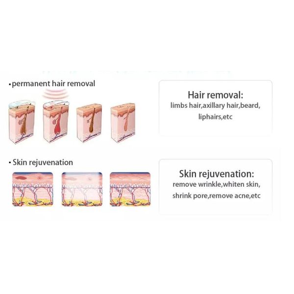 360 Magneto Optic OPT SHR Elight IPL Beauty Machine For Hair Removal / Skin Rejuvenation