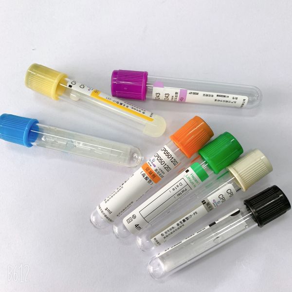 Разделитель 1-6мл сыворотки системы собрания крови вакуума ЛЮБИМЦА ПП стеклянный