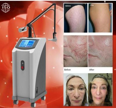 Fractional CO2 laser equipment / CO2 Fractional laser / Fractional CO2 laser for vaginal tightening and scar removal