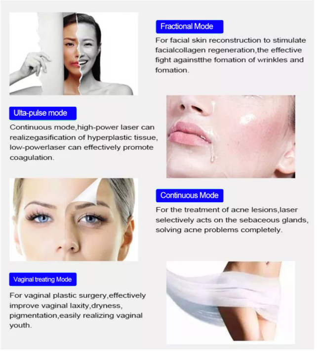 RF Tube C02 Fractional Laser Equipment For Skin Resurfacing Stretch Mark Removal