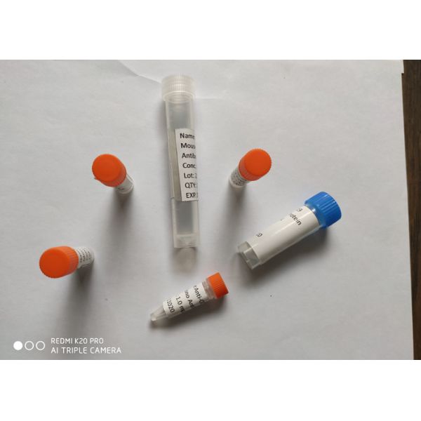 Антитело рекомбинатного шипа антитела кролика (2019-NCoV) нейтрализуя, антитело кролика