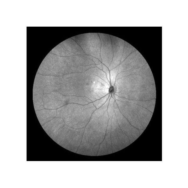 Оборудование камеры Fundus сканирования лазера профессиональное офтальмическое с Fundus отображая размер зрачка FOV 160° минимальный 2 mm