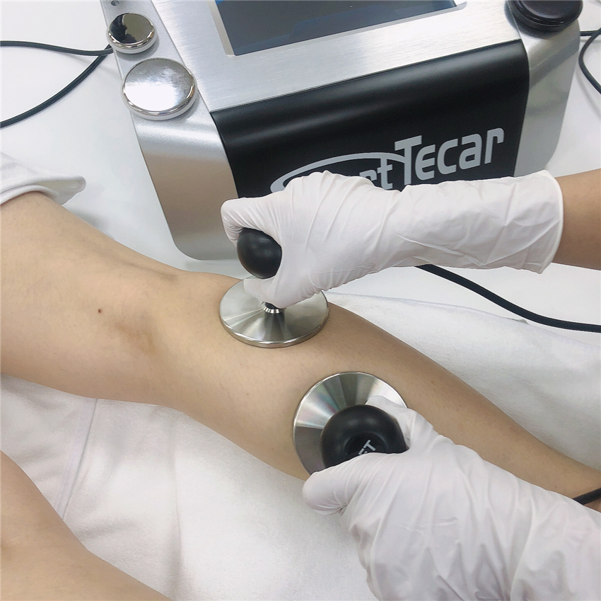 Портативная машина терапией Tecar диатермии для растяжения Plantar Fasciitis лодыжки Injuiry спорта