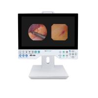 15 pouces FHD Système de caméra d'endoscope flexible et rigide avec lecture et fonction de stockage USB