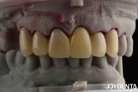 CAD CAM Processing Dental PMMA Material Multilayer Design Pour les transitions naturelles de l'ombre