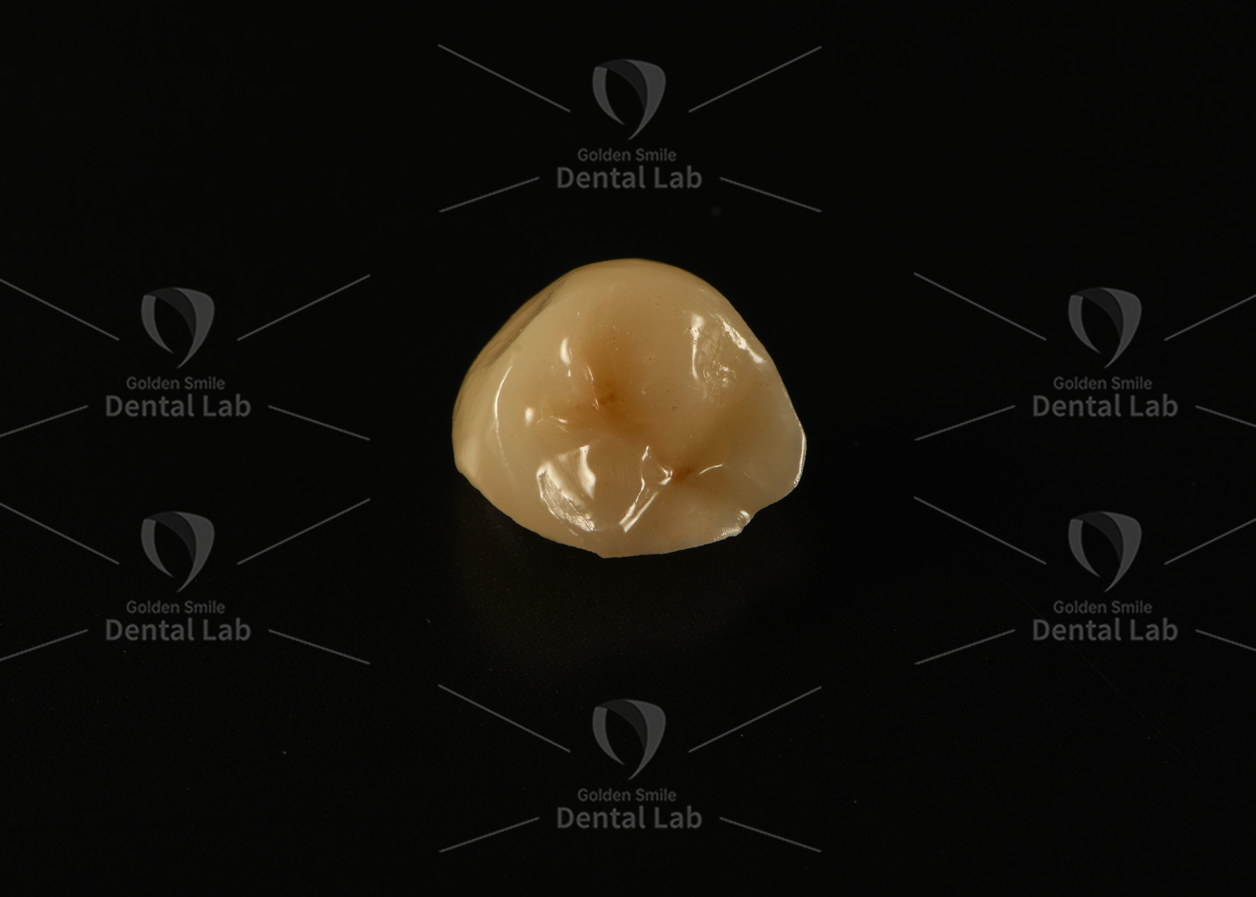 Custom Metal-free Full-Zirconia Crown and Inlay with High Fracture Resistance and Precise Marginal Fit