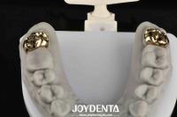 Rehabilitación oral con dentista logran sonrisa más brillante y saludable