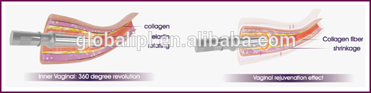 Portable Fractional CO2 Laser Machine for Skin Rejuvenation  Scar Removal and Vaginal Therapy