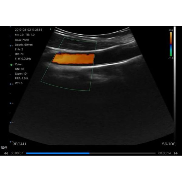 Cuerpo linear cardiaco 3 del PDA de Digitaces del ultrasonido del escáner de la conexión inalámbrica de Wifi EN 1 radio que carga 6 idiomas