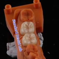 Full Contour Circonia coroa translúcida 3D PRO sem revestimento de porcelana