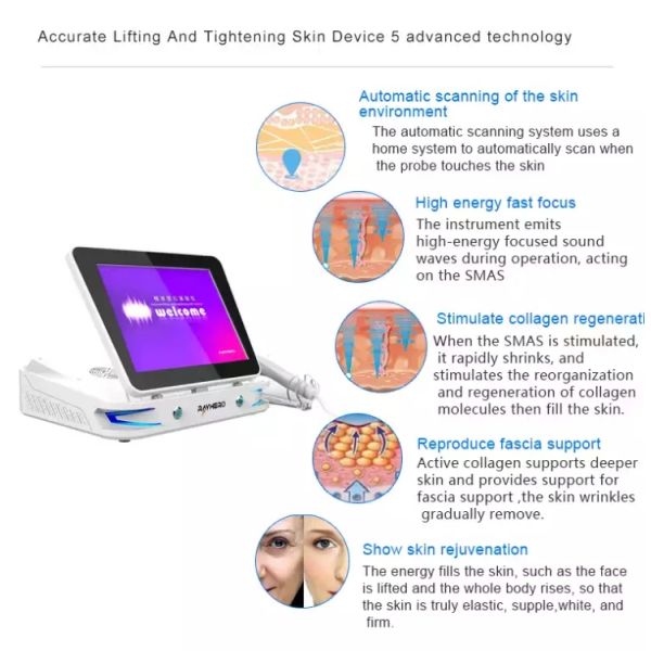 3D High Intensity Focused Ultrasound Face Lift Machine For Double Chin