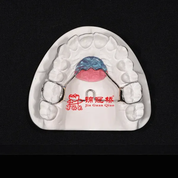 3D Printing Minimal Prep Orthodontic Arch Expander For Teenager