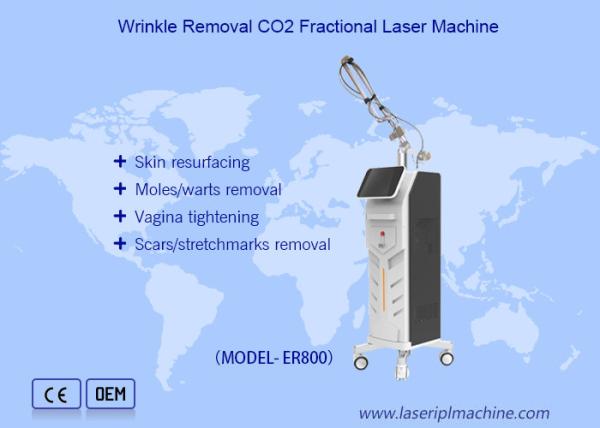 O diodo emissor de luz descasca a máquina 1MHz do emagrecimento do corpo da cavitação do rejuvenescimento para a cara e o corpo