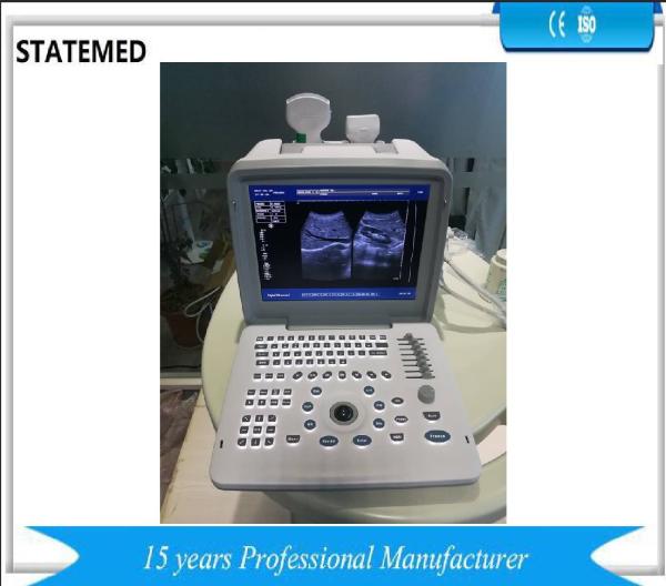 Black White Portable Ultrasound Scanner Equipment For Obstetrics / Gynecology