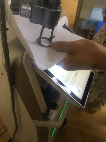 Tratamento fracionário do laser do anti CO2 popular da idade para a remoção da cicatriz, máquina do rejuvenescimento da pele
