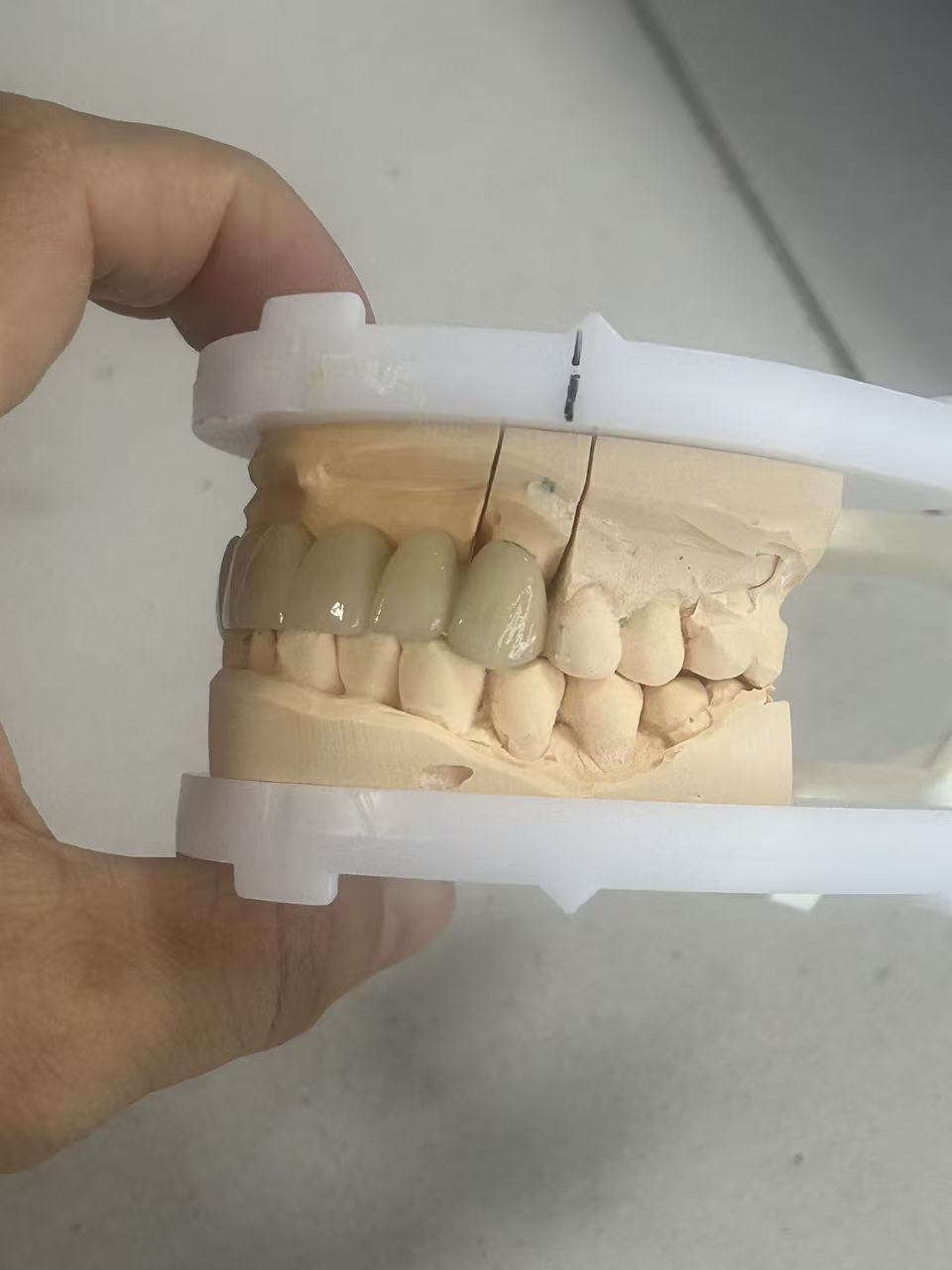 High Fracture Resistance Full Zirconia Dental Crown with Natural Translucency and CAD/CAM Digital Production