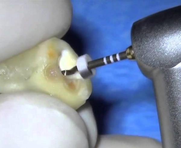 O ouro térmico flexível de Niti do titânio do níquel arquiva o tipo giratório calor - ativação