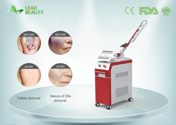 1064nm & 532nm Q Switch ND Yag laser tattoo removal machine/laser tattoo removal 2000mj