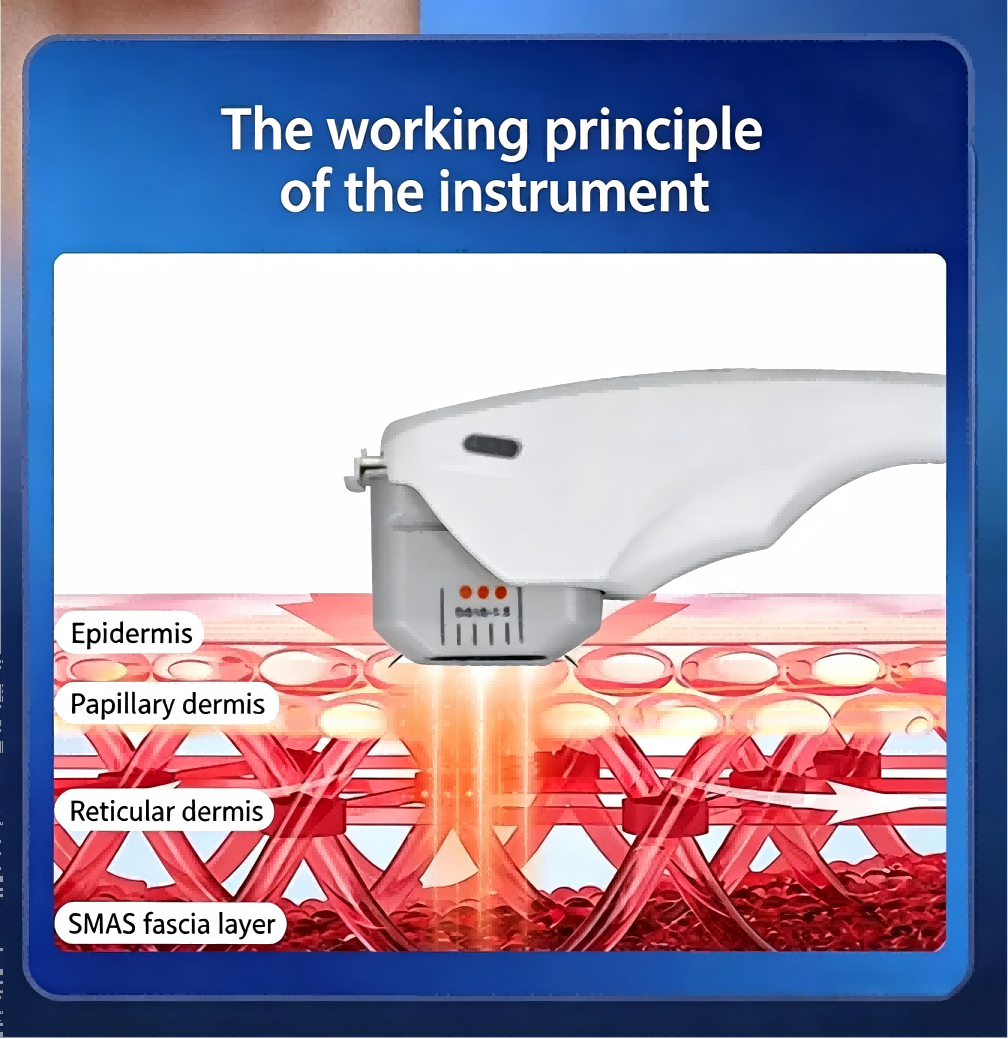 Compact HIFU Machine for Small Salons | Facial Lifting & Skin Tightening
