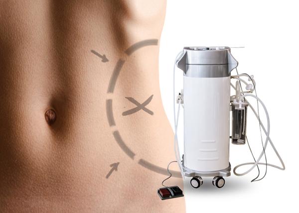 Aesthetic Surgical Liposuction Machine For Abdomen / Upper Arm Surgical Suction Slimming Machine