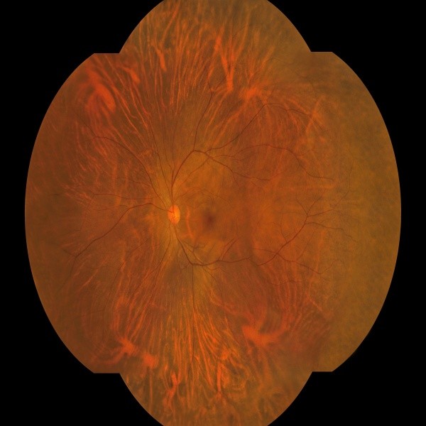 8μm Optical Resolution Wide Field Fundus Camera with 27-inch HD Color Monitor and Automatic Focus for Ophthalmic Diagnostics