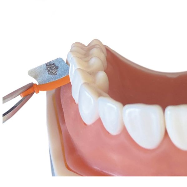 Dental Sectional Matrix System Wedge Guards M3 3.0