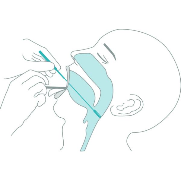 Specimen Collection Flocked Nylon Swab Nasopharyngeal Oropharyngeal Swab For Covid-19