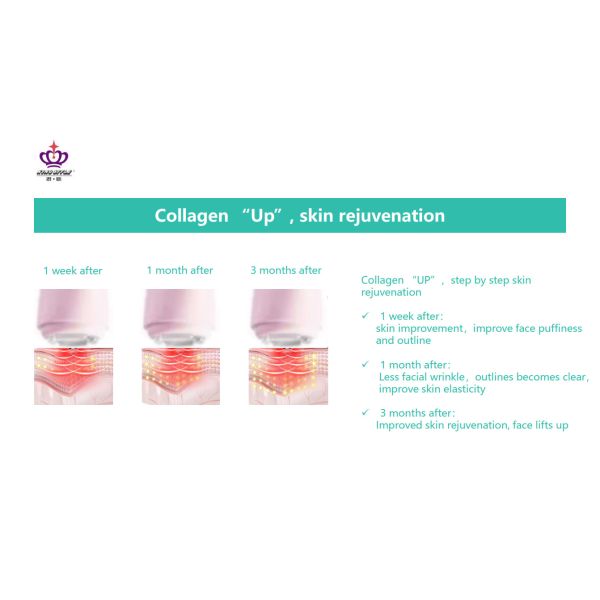 5V Cordless CE Anti Wrinkle RF Beauty Instrument