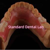Alta estética Flexible Valplast Dentadura parcial fácil de limpiar
