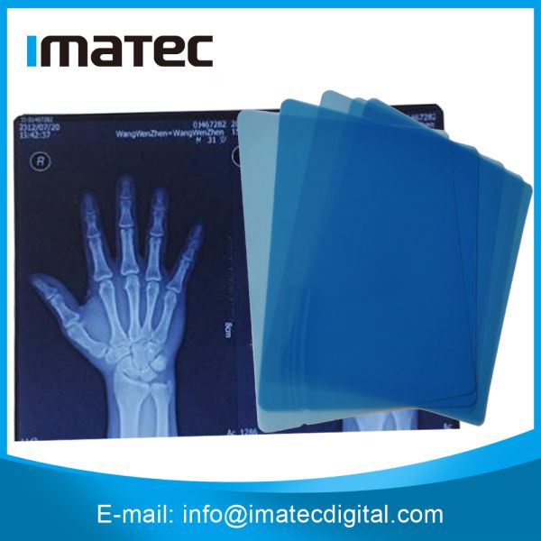 Водоустойчивый медицинский сухой фильм кс Рэй цифров фильма воображения для принтера канона Эпсон