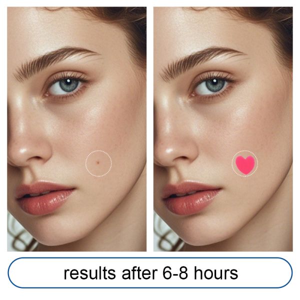 Colorful Heart Shaped Acne Pimple Patch Spot Treatment Patches for Face 12mmx6