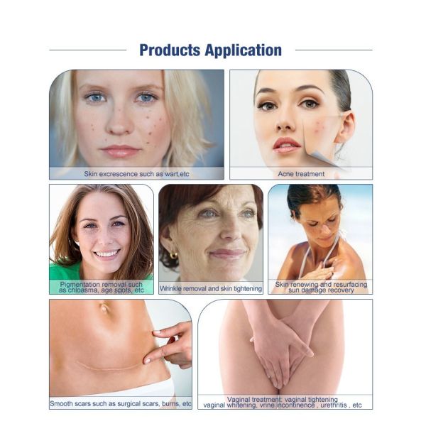 CO2 Fractional Laser Machine For Scar Removal Skin Renewal and Female Intimate Area Tightening and Firmness Enhancement with 10600nm Gold Standard Laser