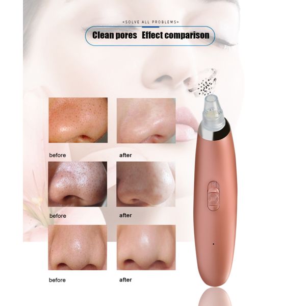 DC 5V Electric Pore Cleanser Blackhead & Acne Remover Rechargeable 2600MAH Battery