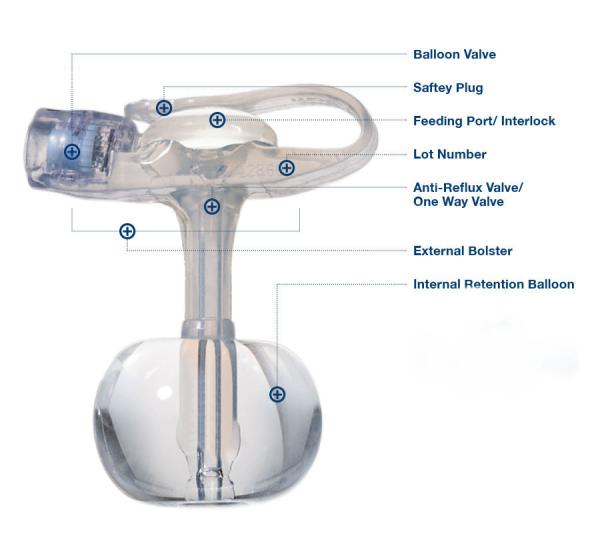 Sterile Silicone Disposable Endotracheal Tube Button Gastrostomy For Adult