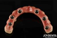 Adjustable Titanium Malong Hybrid Bridge Perfect Combination Of Traditional And Modern Techniques