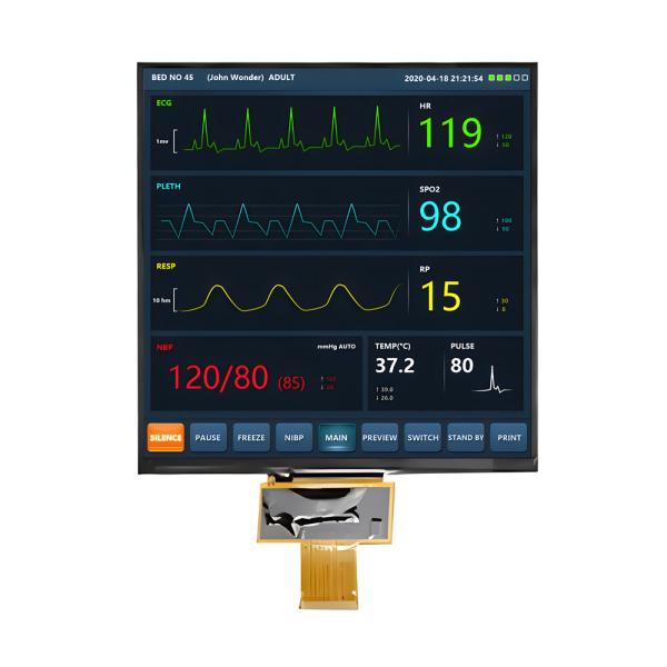 7.6 polegadas quadrado TFT LCD Display 800x800 pixels 1000 Nits Brilho MIPI Interface