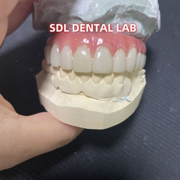 Все на четыре шесть Ивоклара Циркония Имплантат Мост Титановый Стержень С Розовой Порцеляной