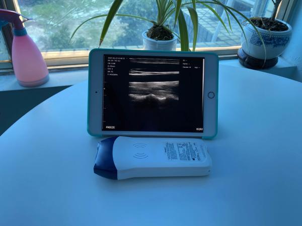 Medical 128 Element Wireless Handheld Color Doppler Linear Ultrasound Probe Built-in Lithium Battery