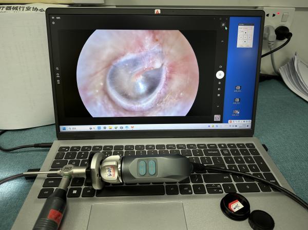 TUYOU Manufacturer USB Portable Endoscope Camera For ENT Endoscopy Pet Checking Video Endoscopy On Laptop