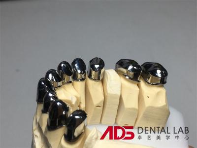 Custom Metal precision Attachment Partial Denture Telescoper